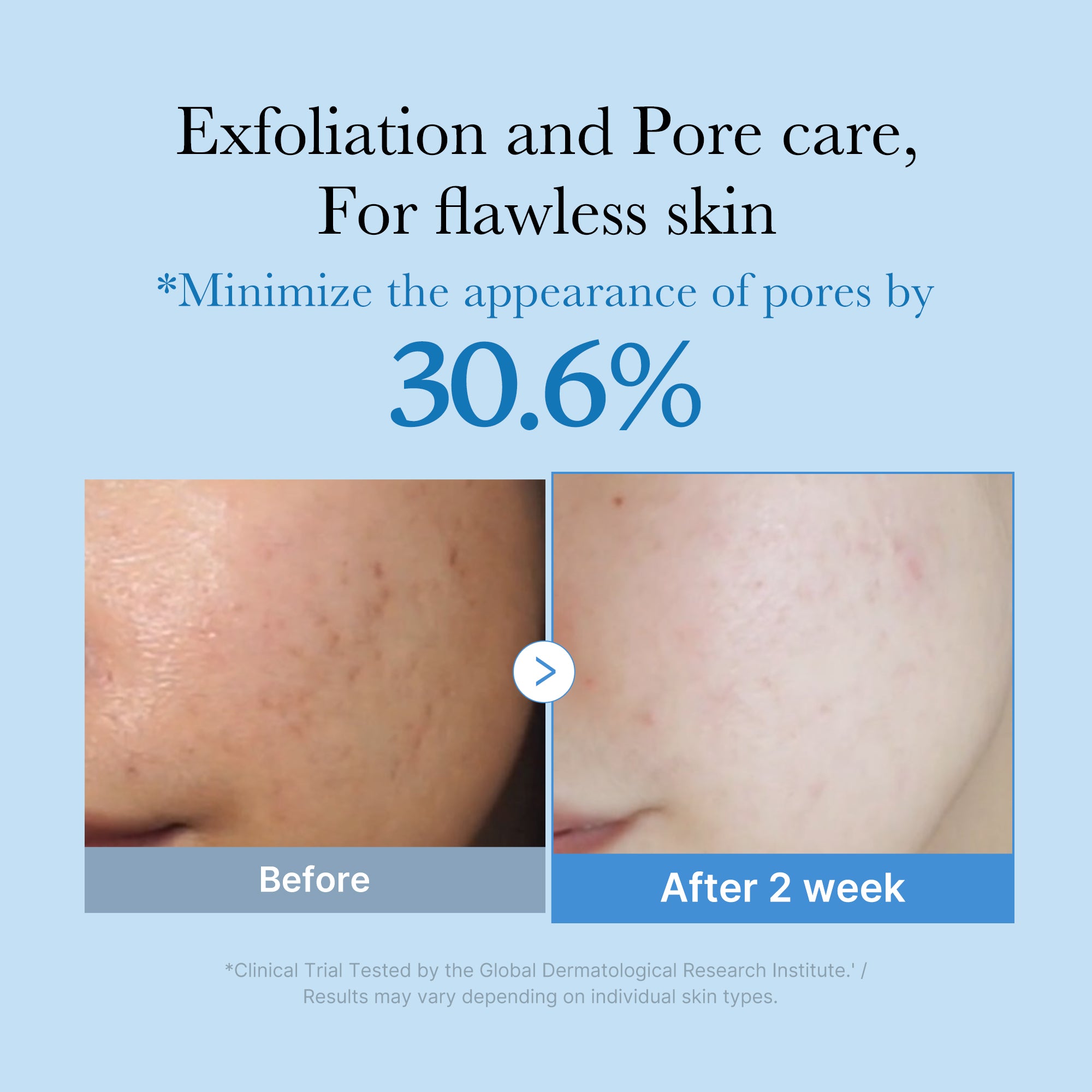 medicube-zero-pore-toner image 2
