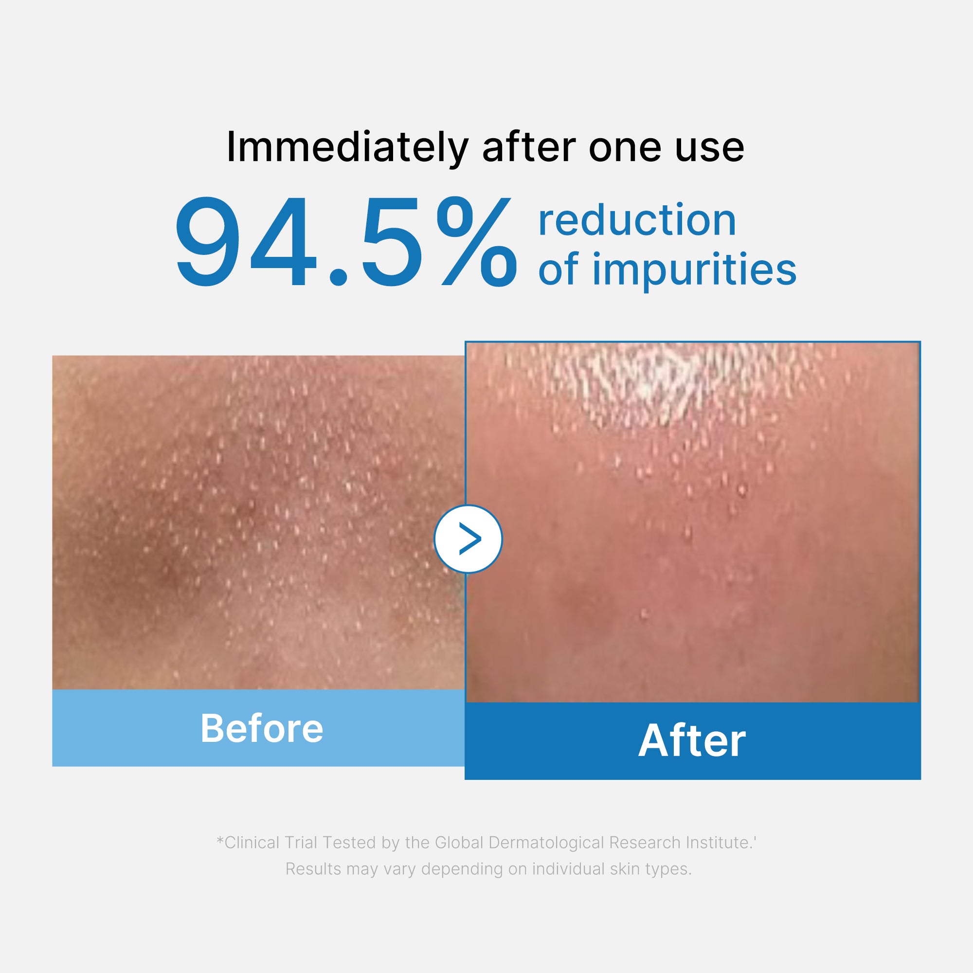 medicube-zero-pore-blackhead-deep-cleansing-oil image 2