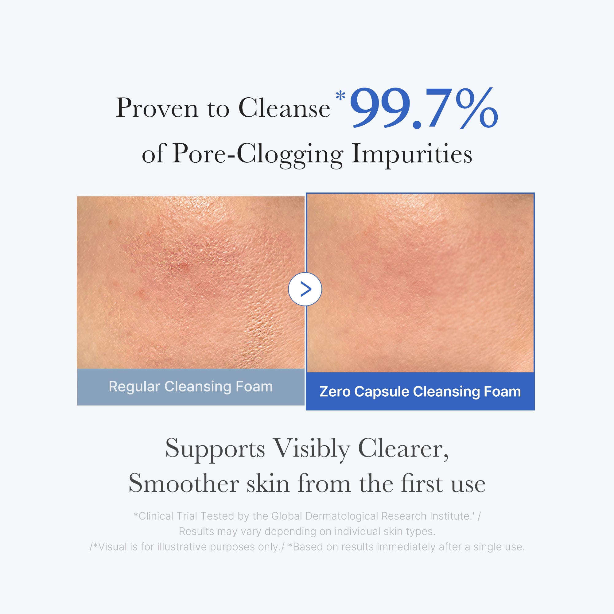 medicube-zero-pore-capsule-cleansing-foam-blue-exosome-pore-refining-cleanser-fo image 3