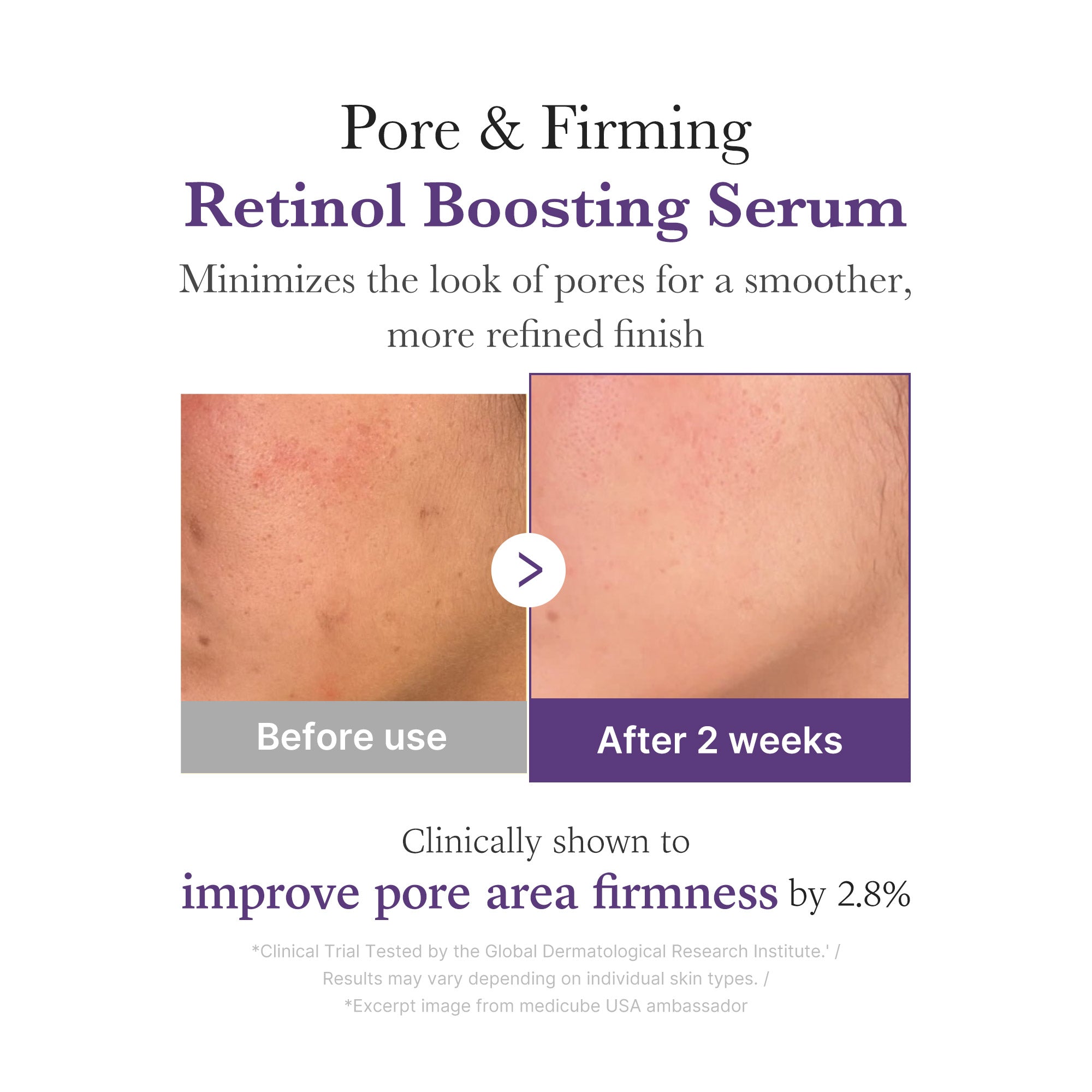medicube-retinol-nmn-boosting-serum image 4