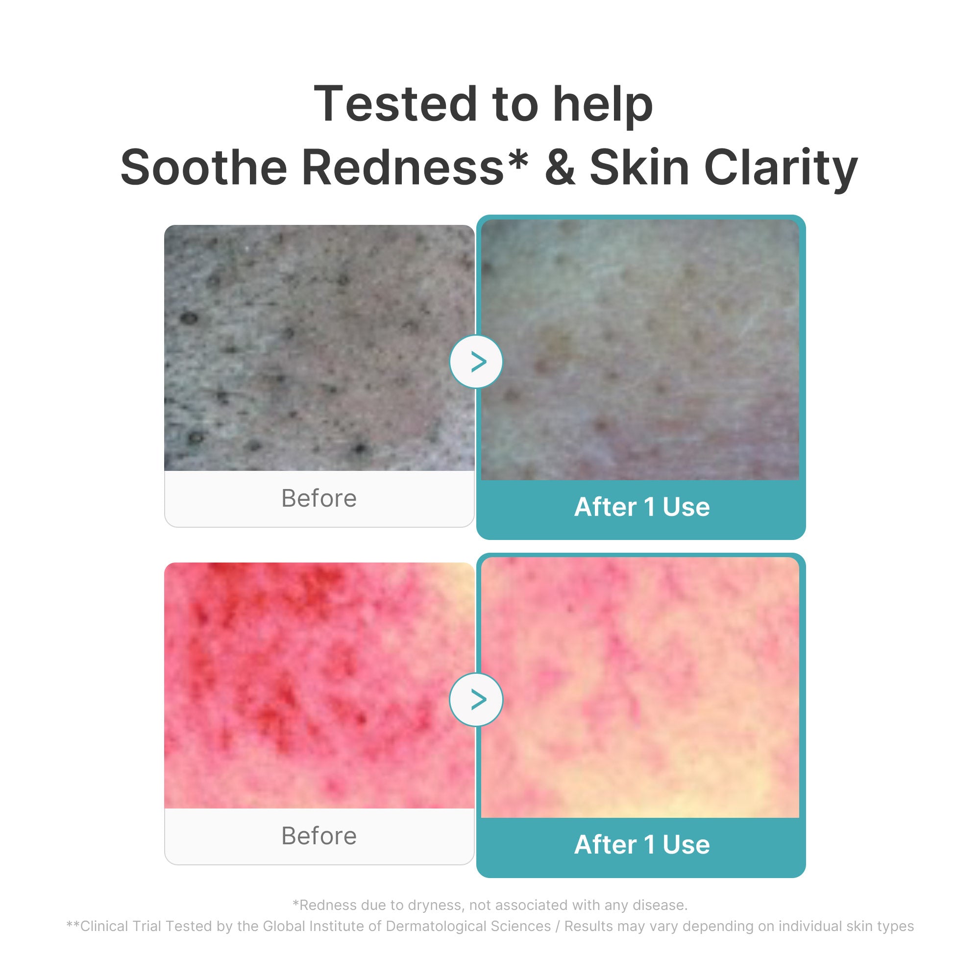 medicube-azelaic-acid-capsule-foam-cleanser-150ml-soothing-daily-cleanser-for-tr image 4