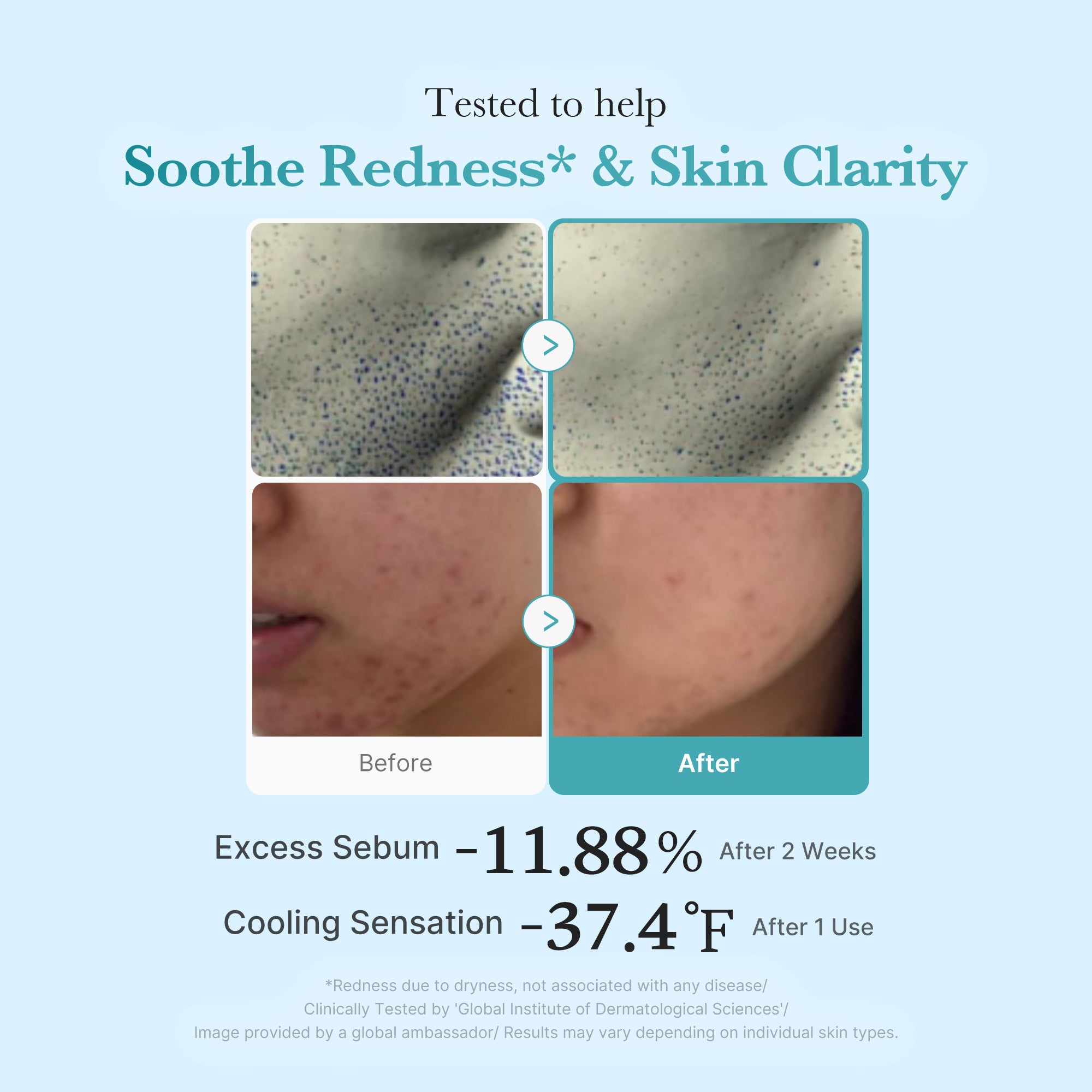 medicube-azelaic-acid-niacinamide-clarifying-toner-4-azelaic-acid-2-niacinamide- image 4