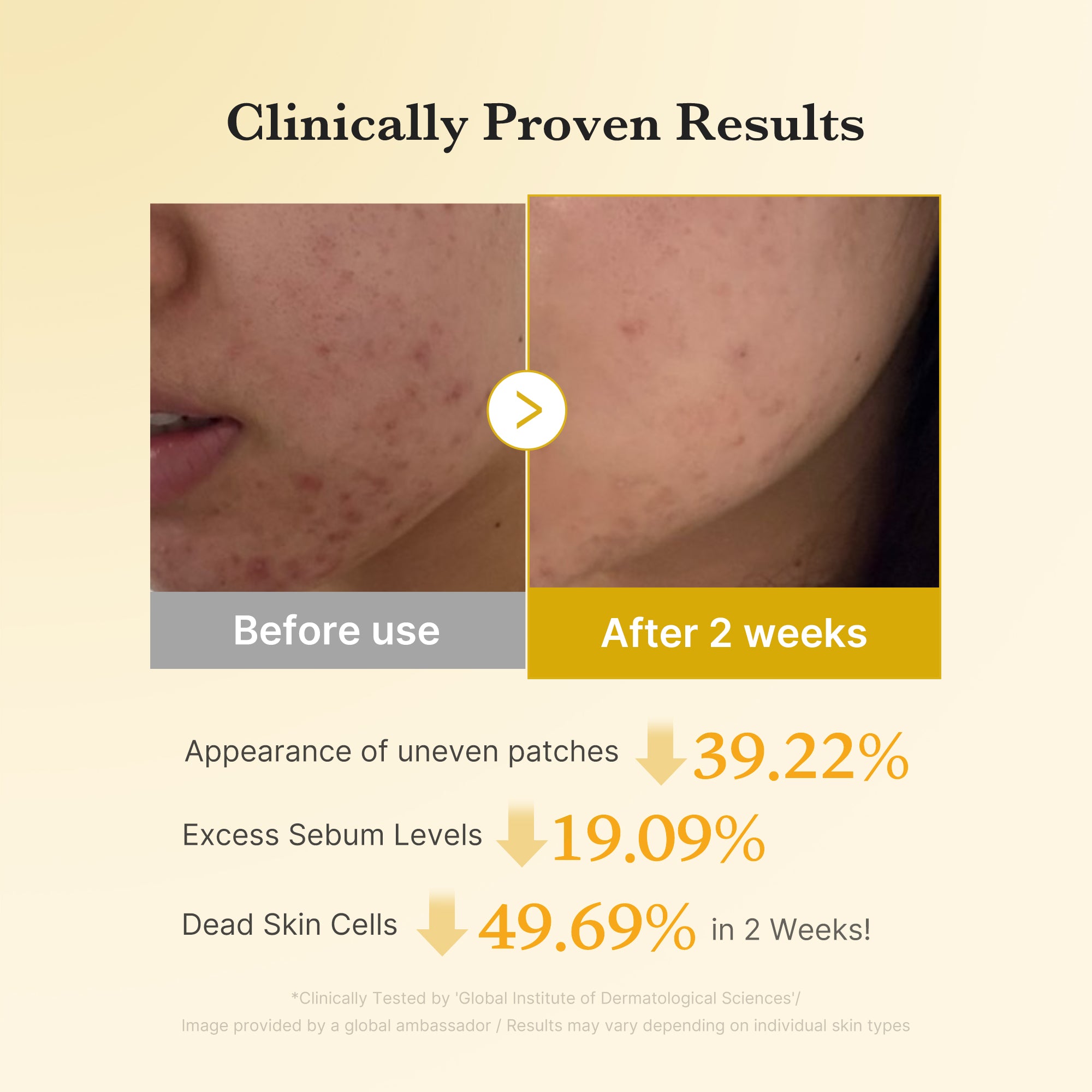 medicube-kojic-acid-turmeric-toner-pad image 4