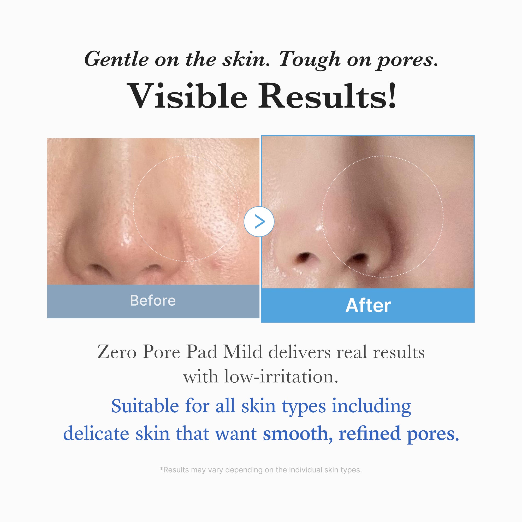 medicube-zero-pore-madecassoside-pads-mild-gentle-pha-exfoliating-pads-for-ultra image 5