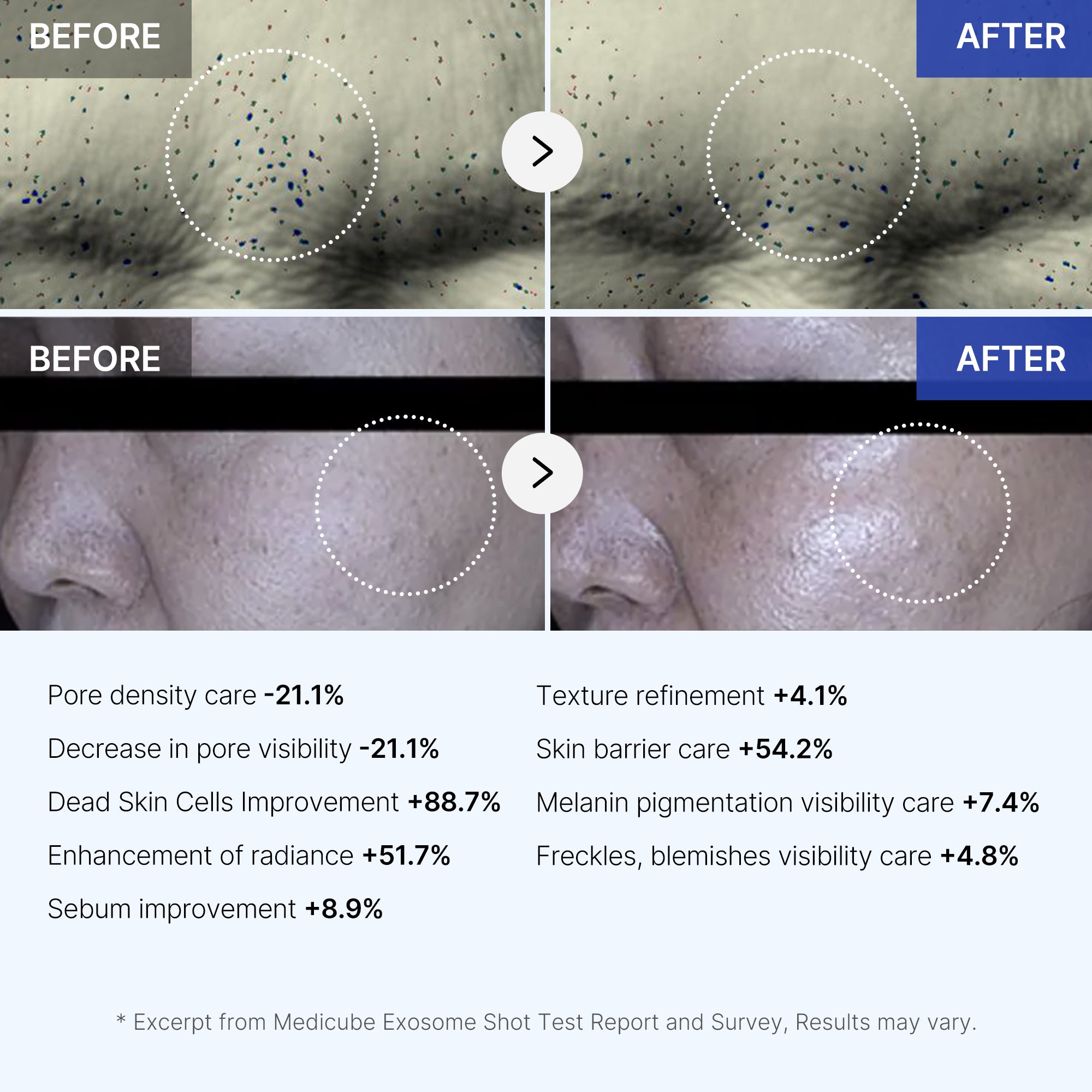 medicube-skin-renewal-ensemble-set-booster-pro-air-shot-zero-exosome-shot-collag image 8