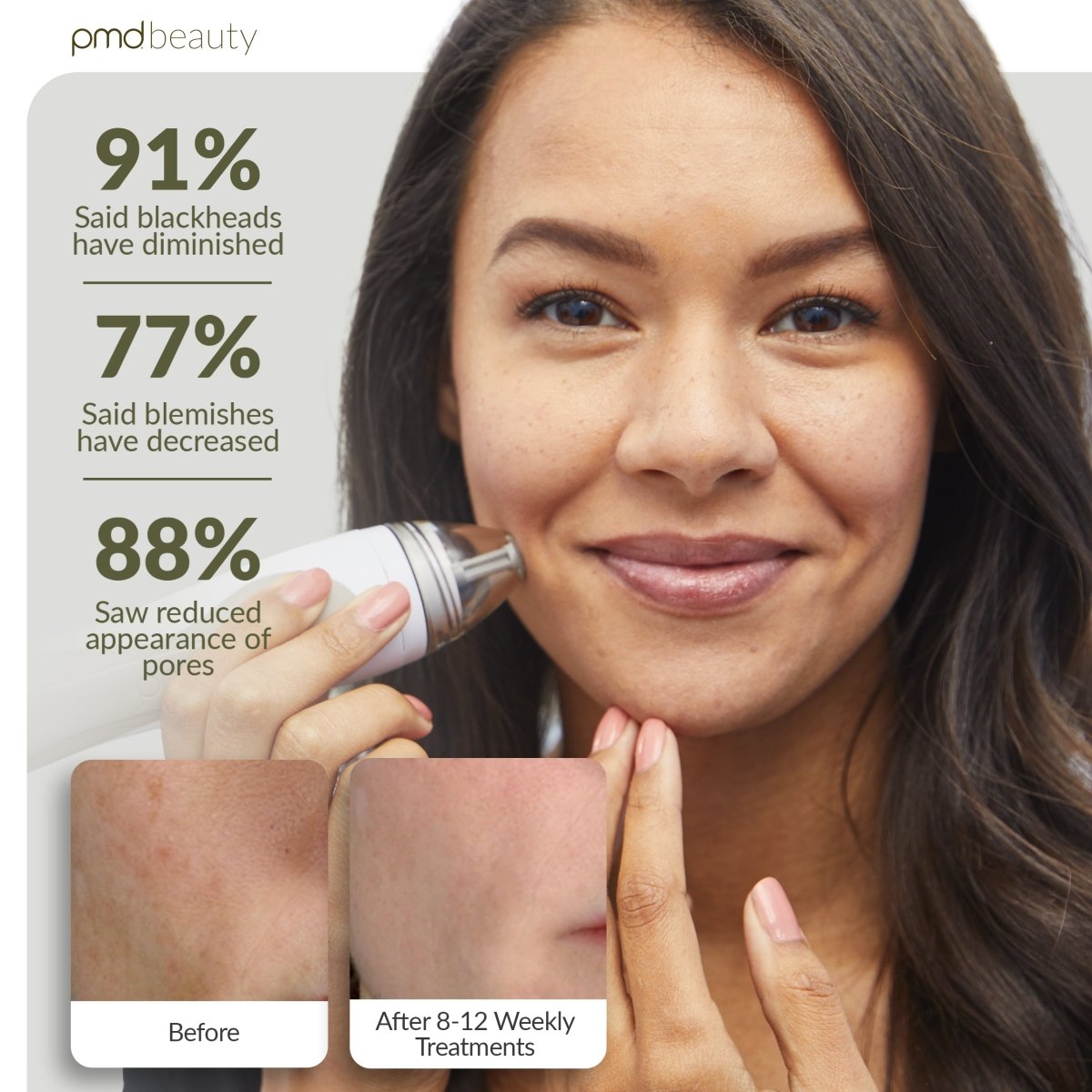 pmd-beauty-personal-microderm-pro-international-220-240v image 4