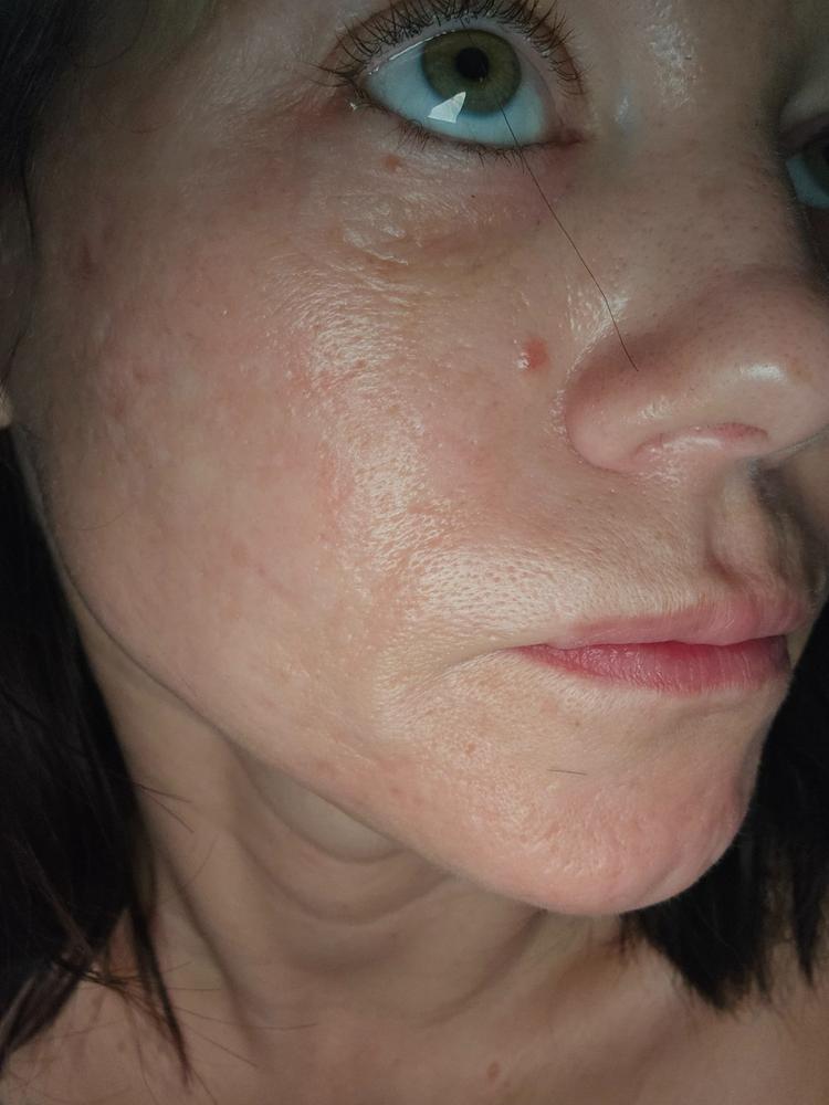 Mediocre for my skin