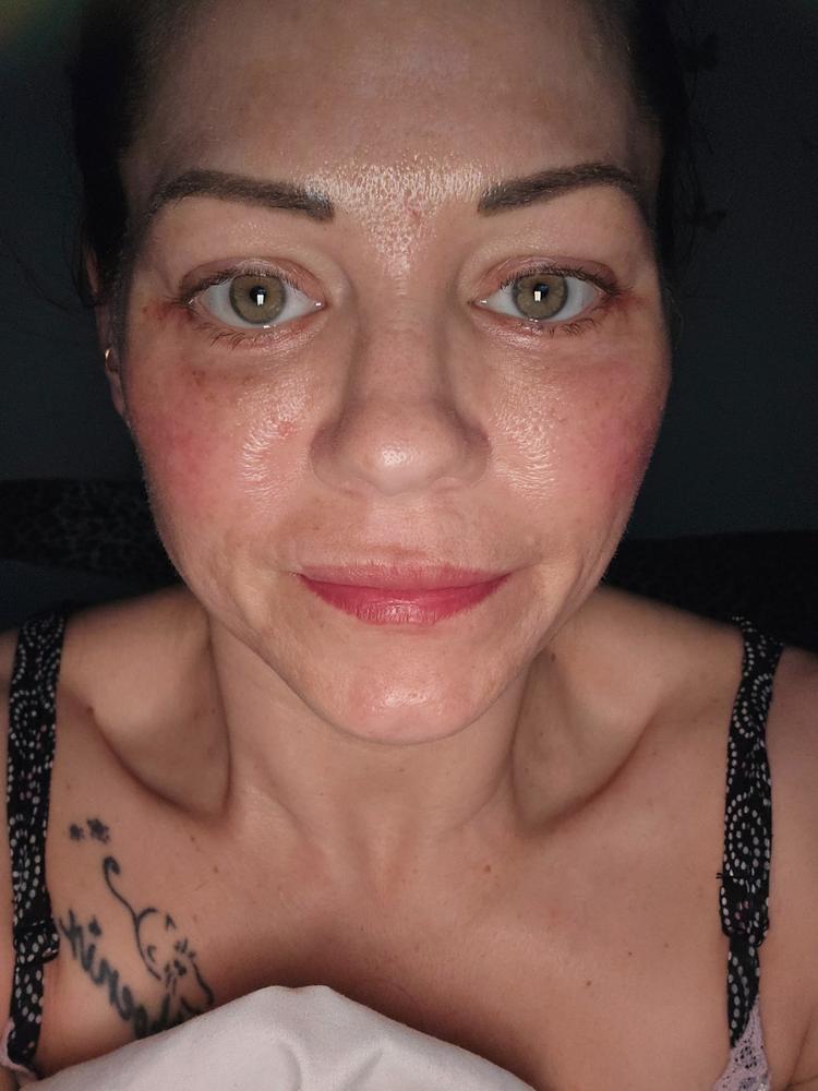 Helped my red spots