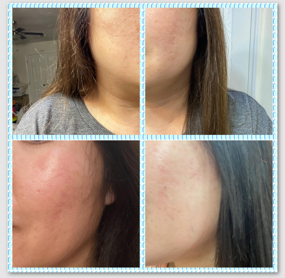 Saved my skin