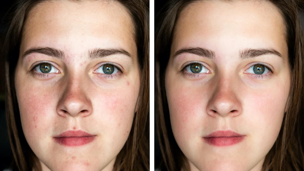 Good for normal skin