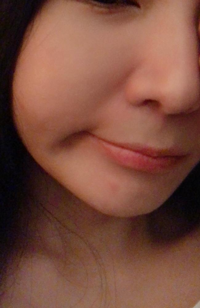 My skin has changed