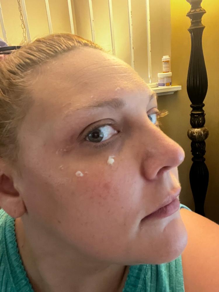 Plumps fine lines