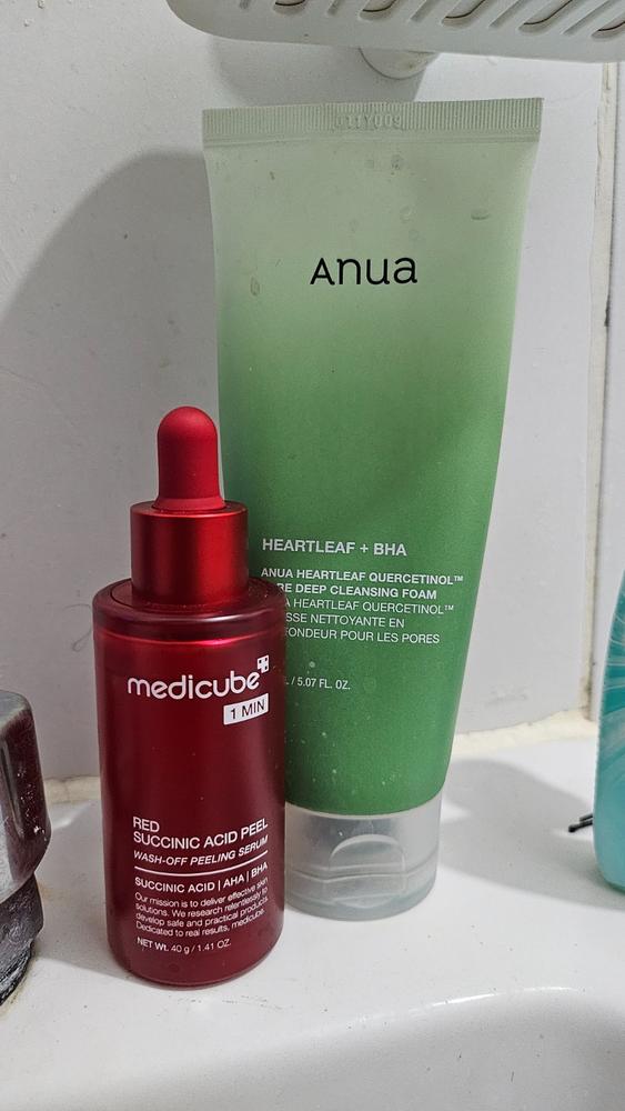 Game changer for my acne