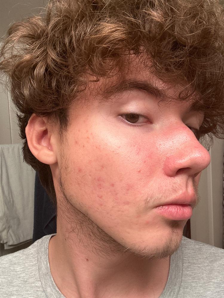 Meh