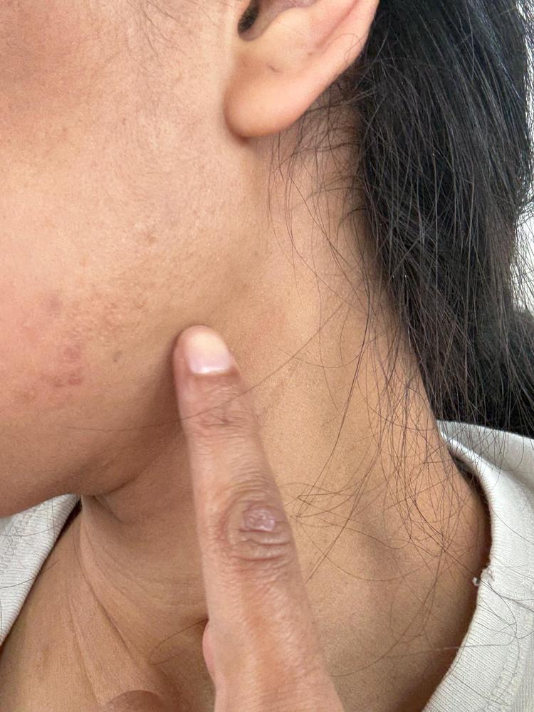 Great for spot treatment