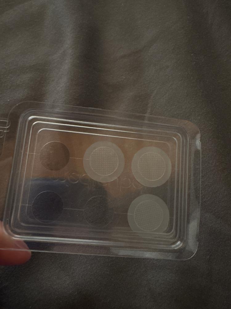My dark spots are fading!
