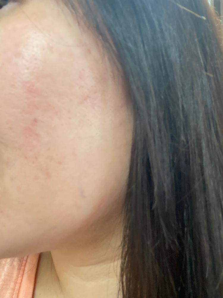 Irritated my skin