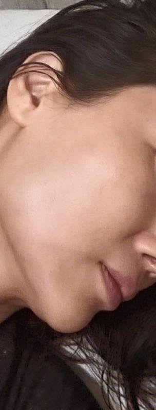 Complete skincare solution