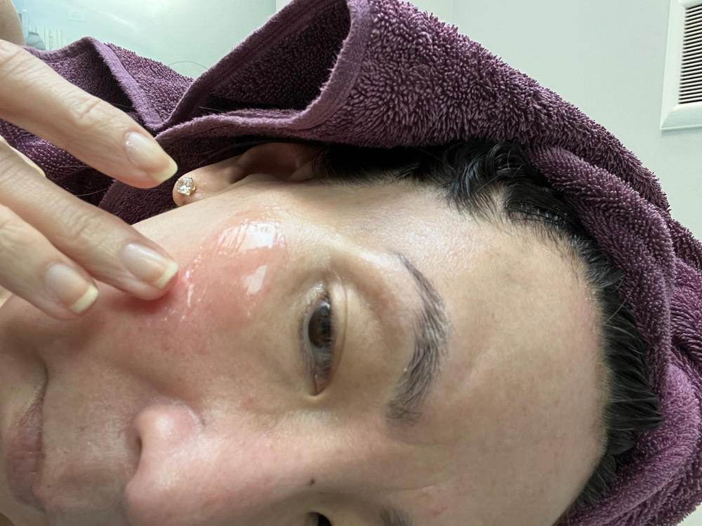 Great for mature skin