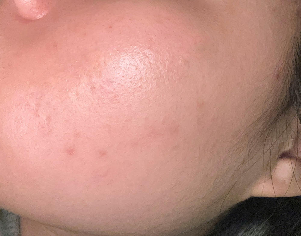 Perfect for my skin