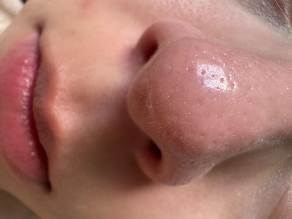 Works, but not for sensitive skin