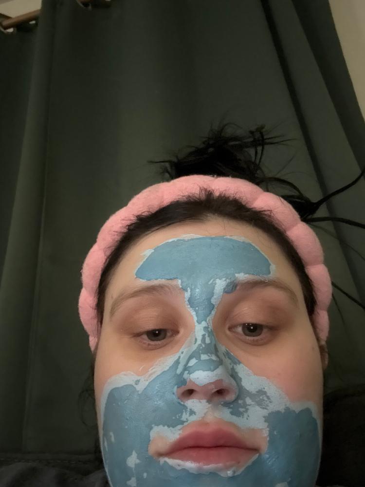 Amazing for blackheads