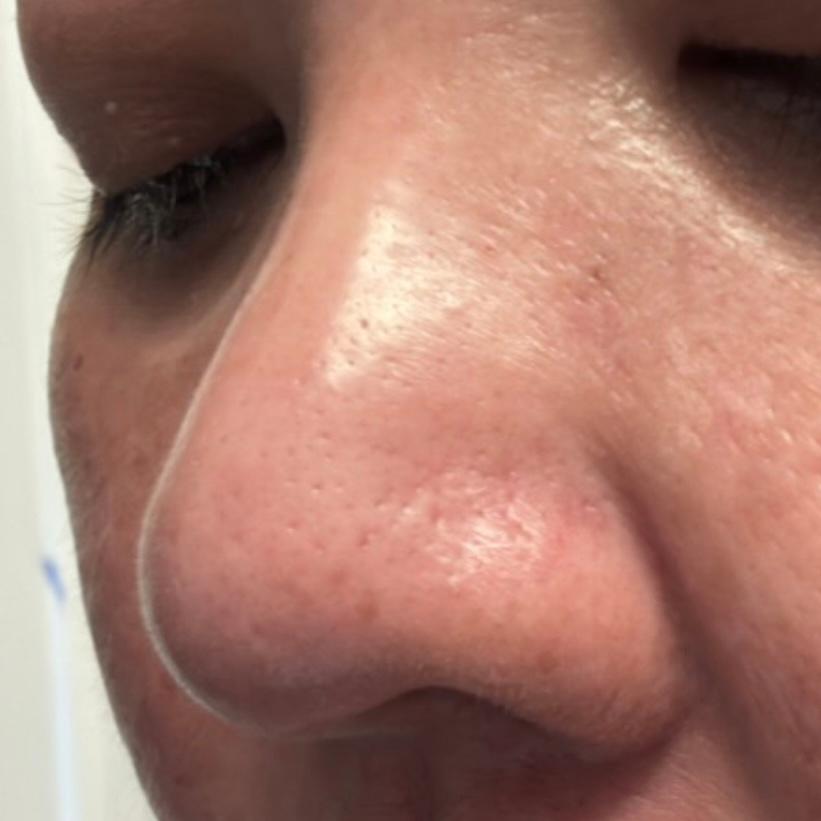 Good for nose