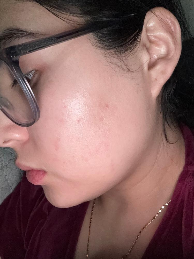 Nice serum but small bottle
