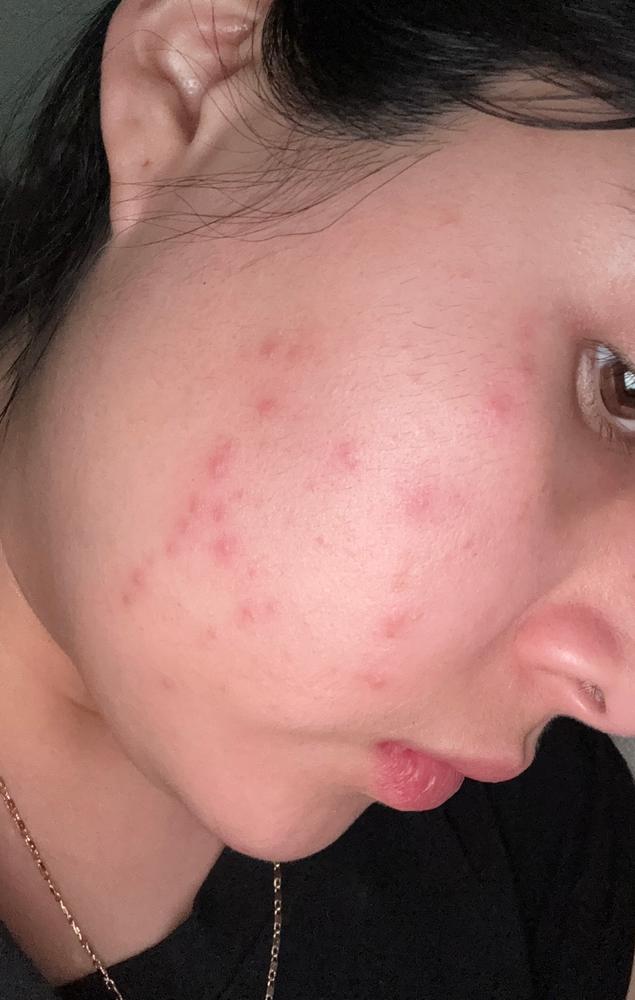 Not for sensitive skin