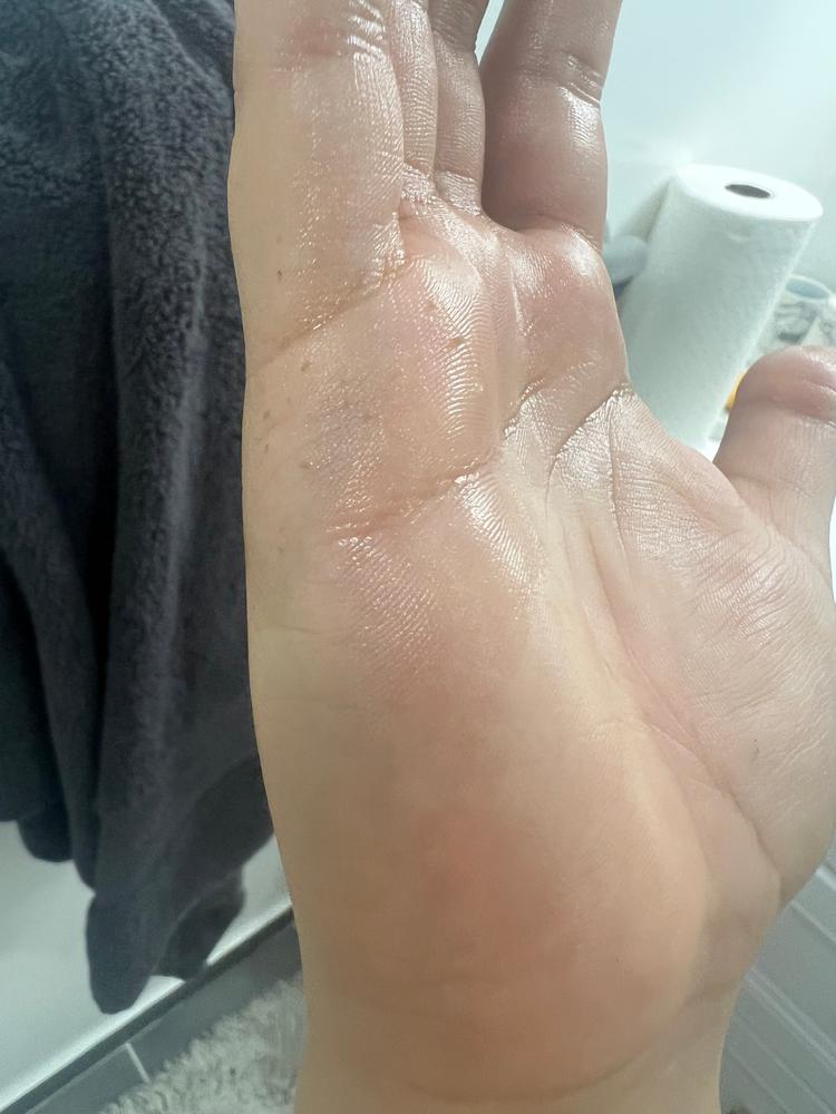 My blackheads are gone!