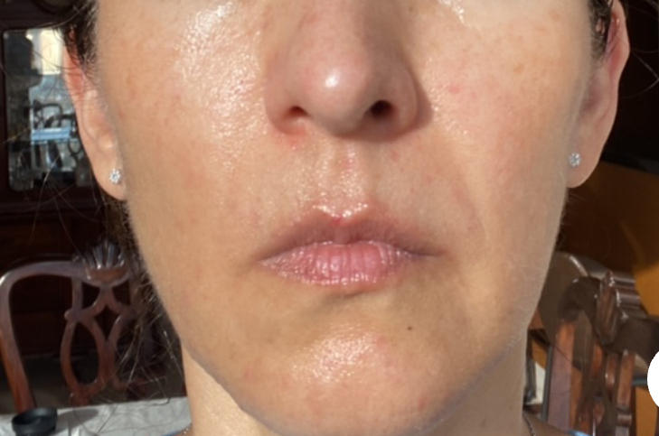 Perfect for acne-prone skin