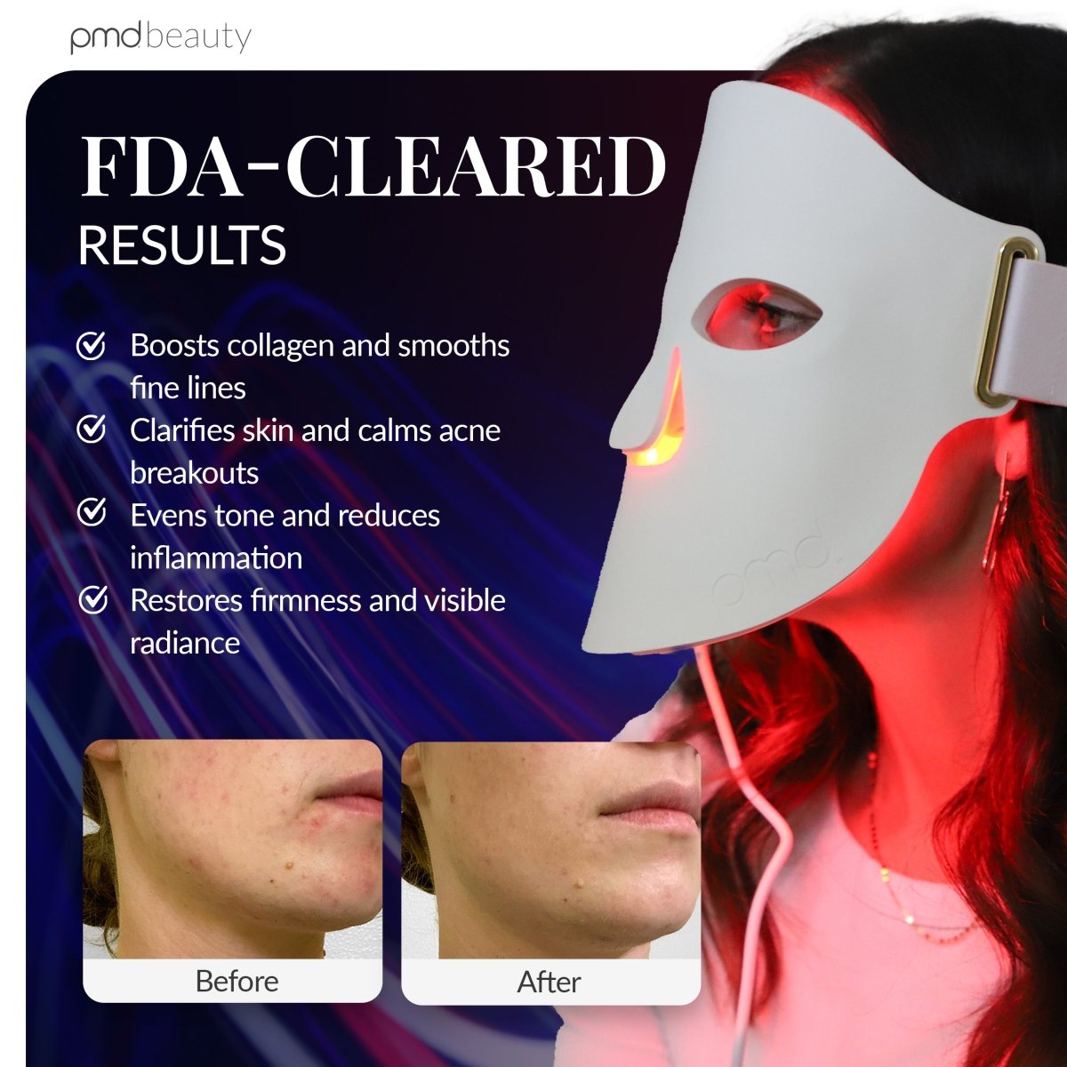 pmd-beauty-led-mask-fda-cleared-full-face-light-therapy image 6