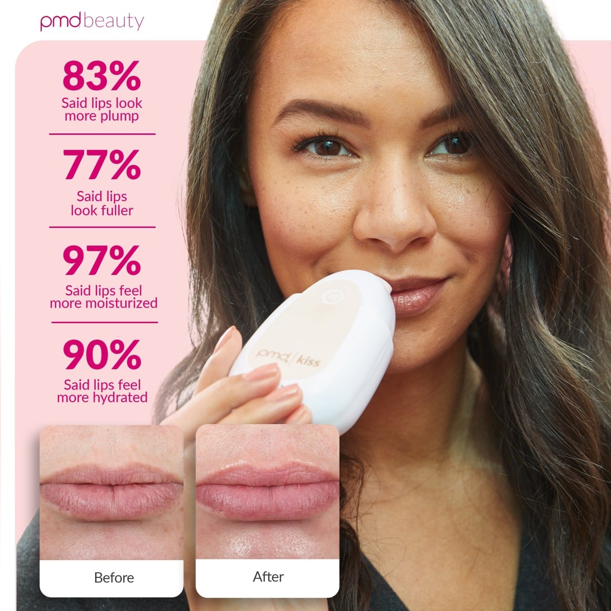 pmd-beauty-kiss-system-lip-plumping-device-with-mask-exfoliator image 4