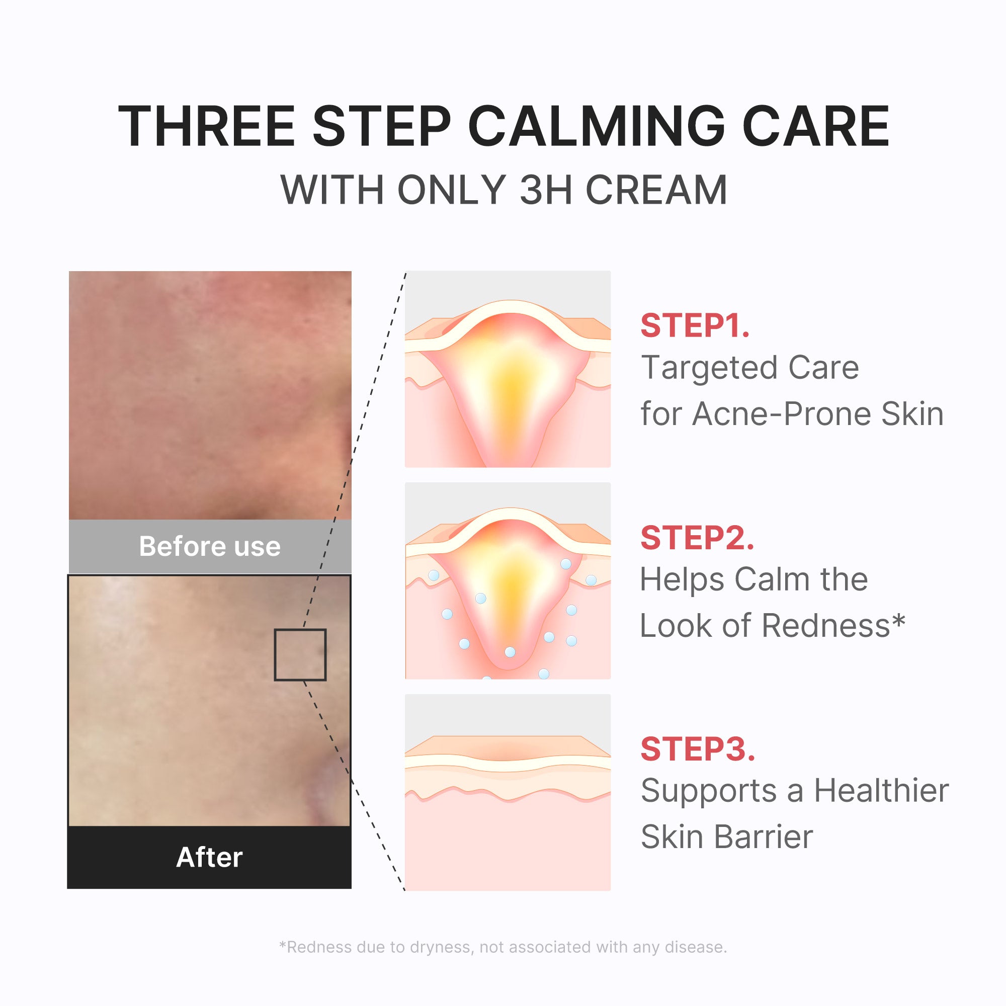 medicube-3h-daily-relief-cream image 5