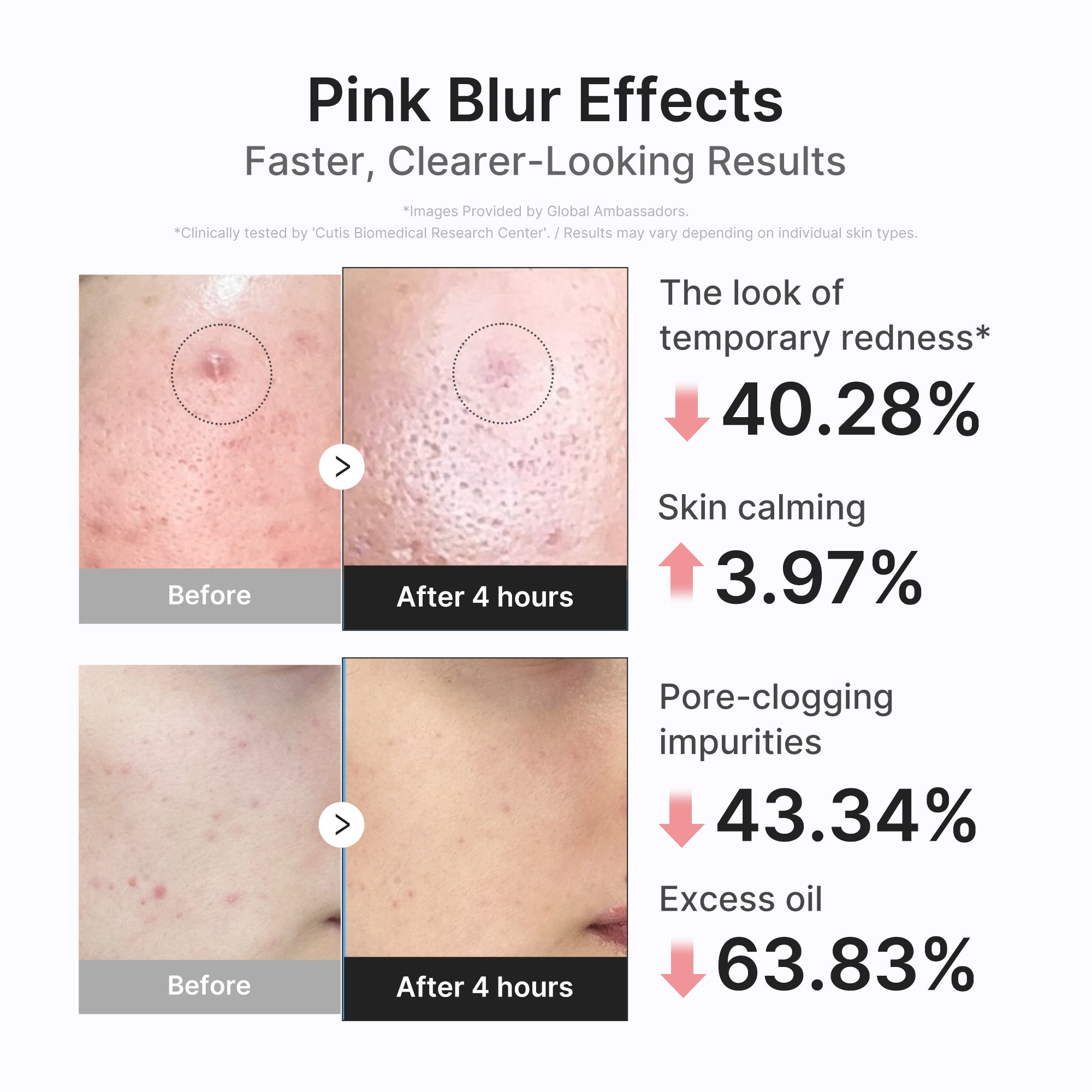 medicube-3h-overnight-drying-lotion-targeted-spot-treatment-for-troubled-oily-pr image 5