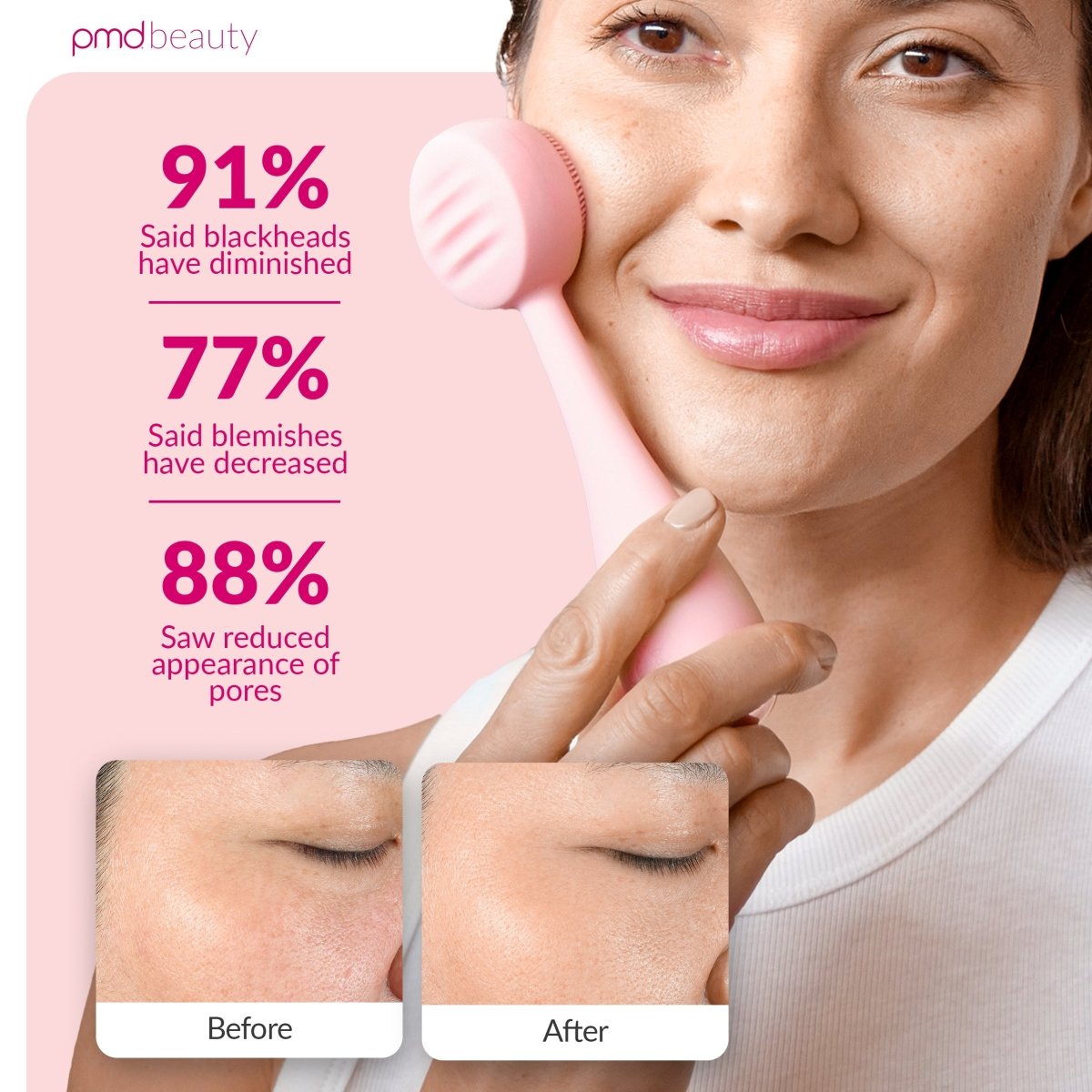 pmd-beauty-pmd-clean-sonic-deep-cleansing-anti-aging-device-30-off-limited-time image 5