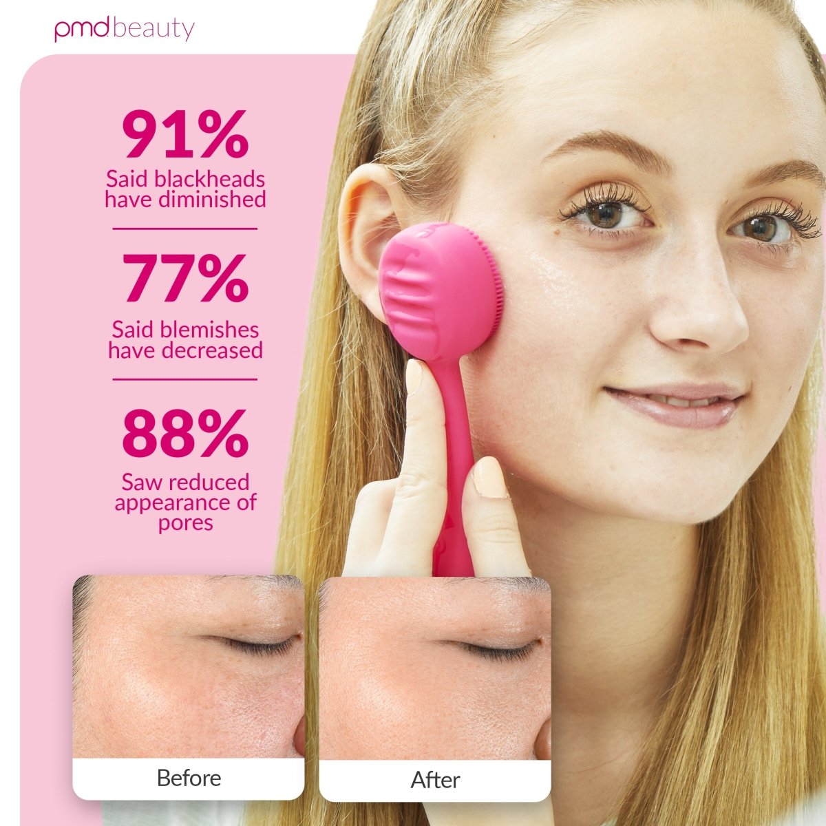pmd-beauty-clean-for-teens-sonicglow-deep-cleansing-device image 4