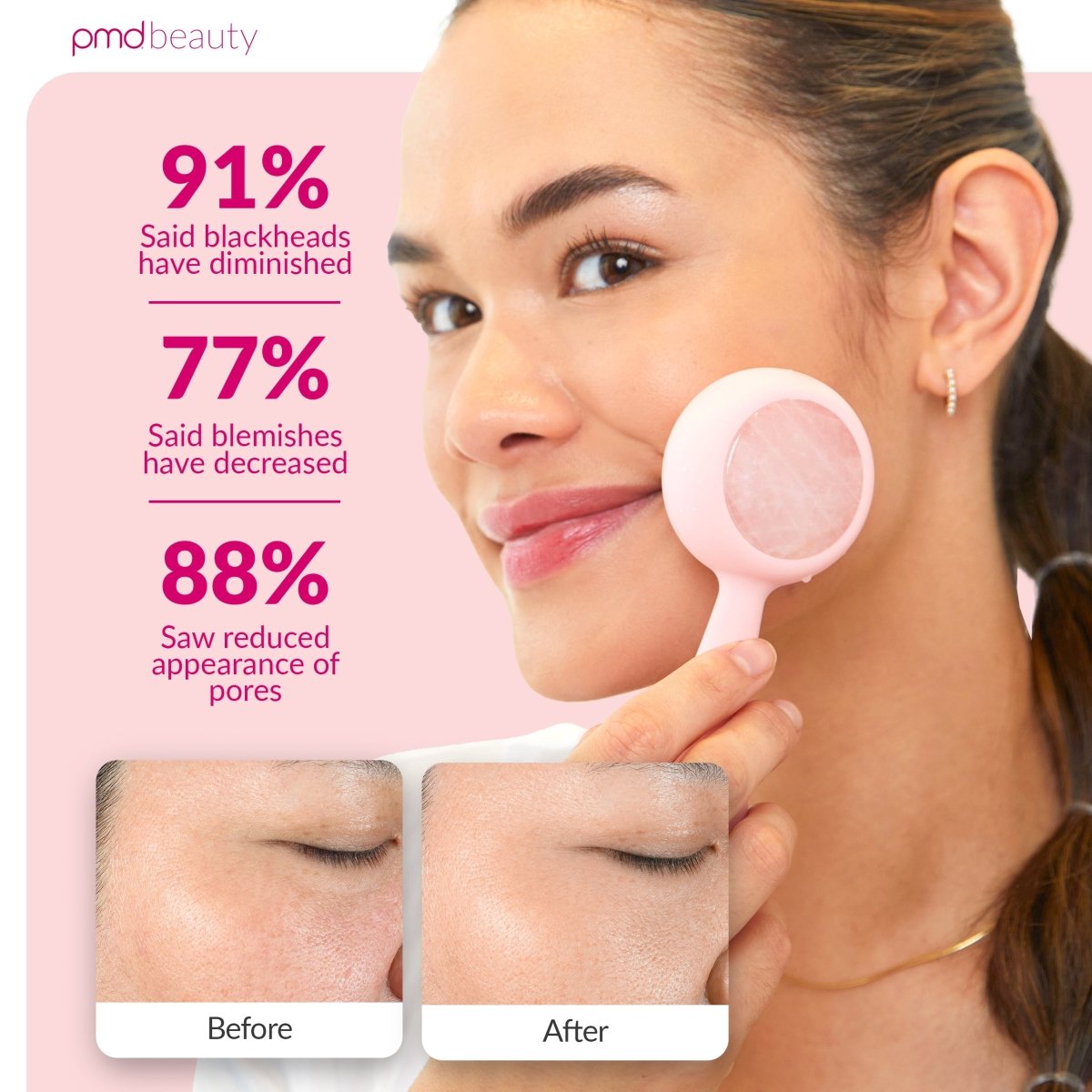 pmd-beauty-clean-pro-rq-sonicglow-rose-quartz-facial-cleansing-device image 4