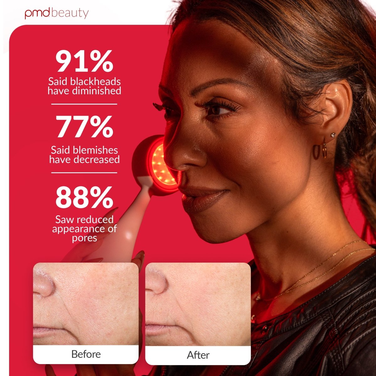 pmd-beauty-led-clean-redvolution-red-light-therapy-sonic-cleansing-device image 4