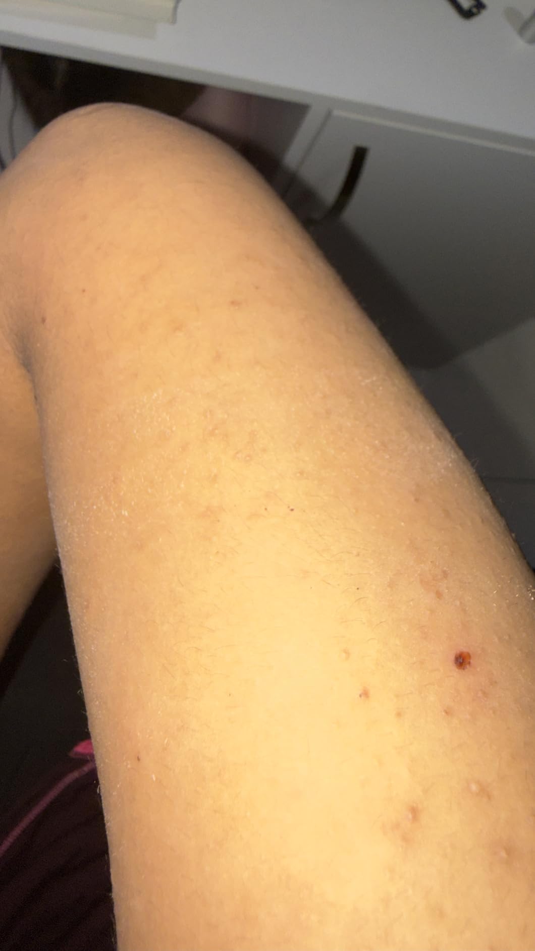 Smooth legs in 2 weeks