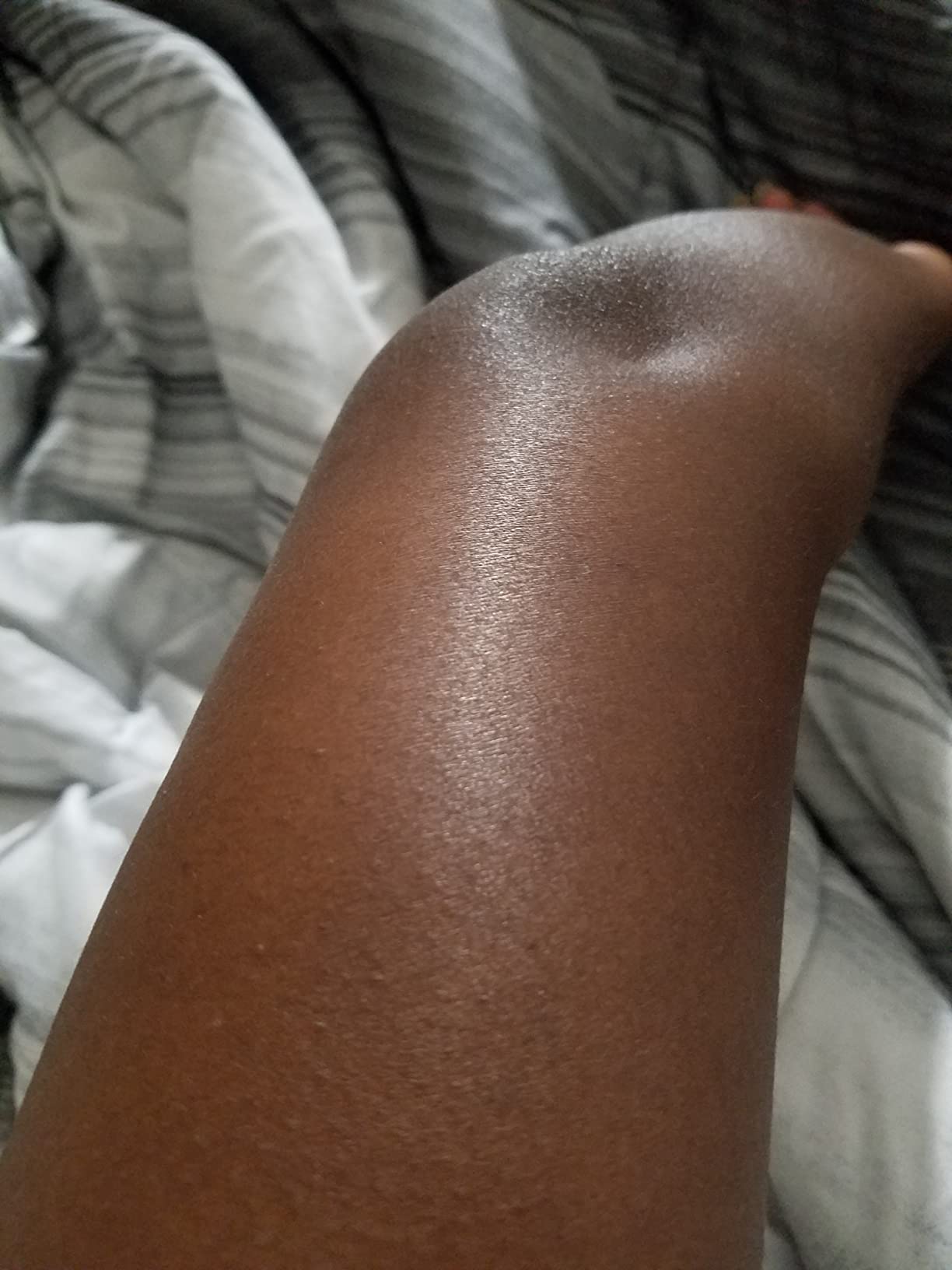 No more dry patches
