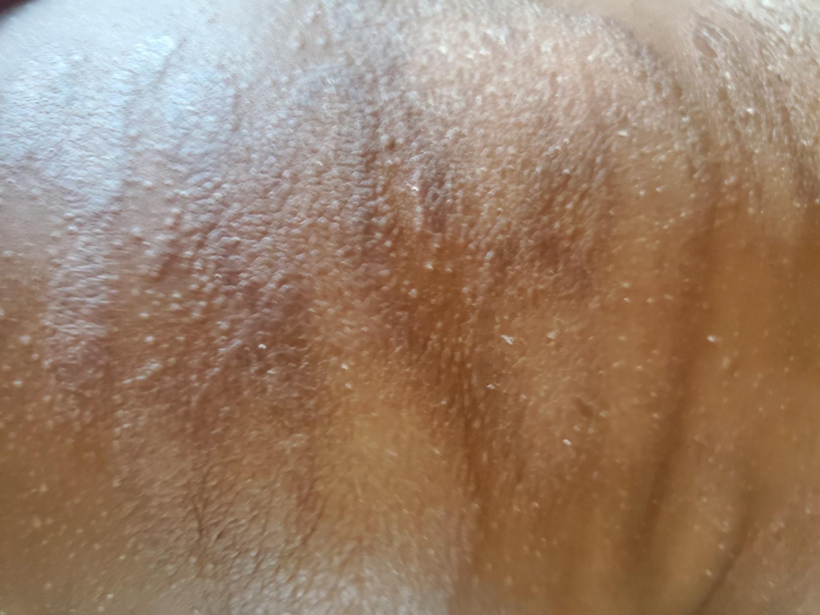 Saved my baby's skin