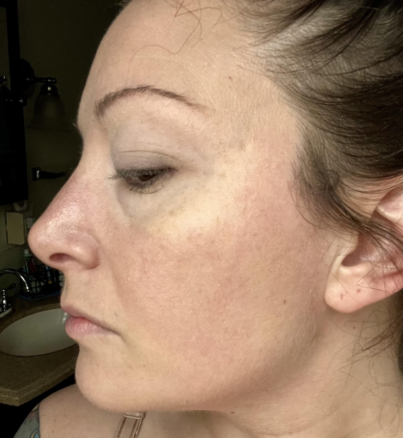 Finally, a redness relief that works!