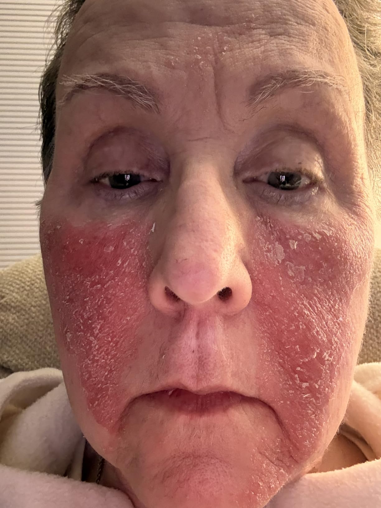 Visible results in 2 weeks!