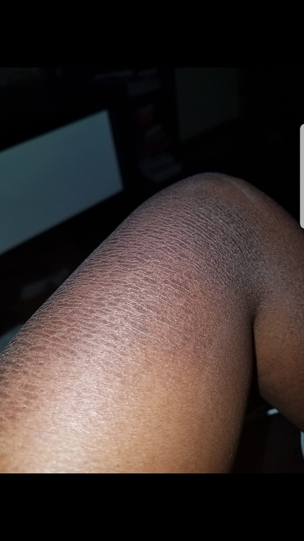 Calms my skin