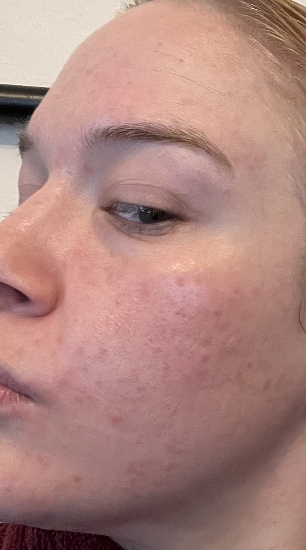 Good serum