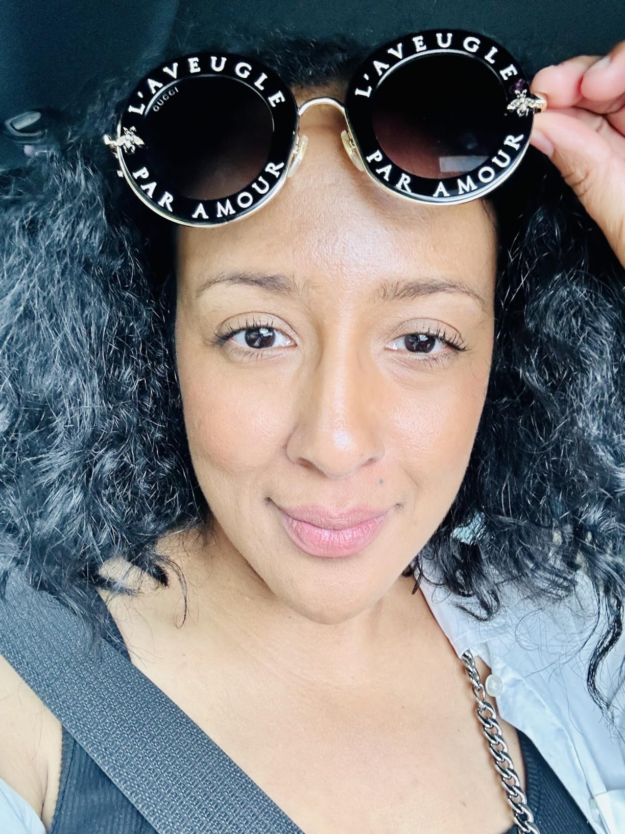 My dark spots are fading!