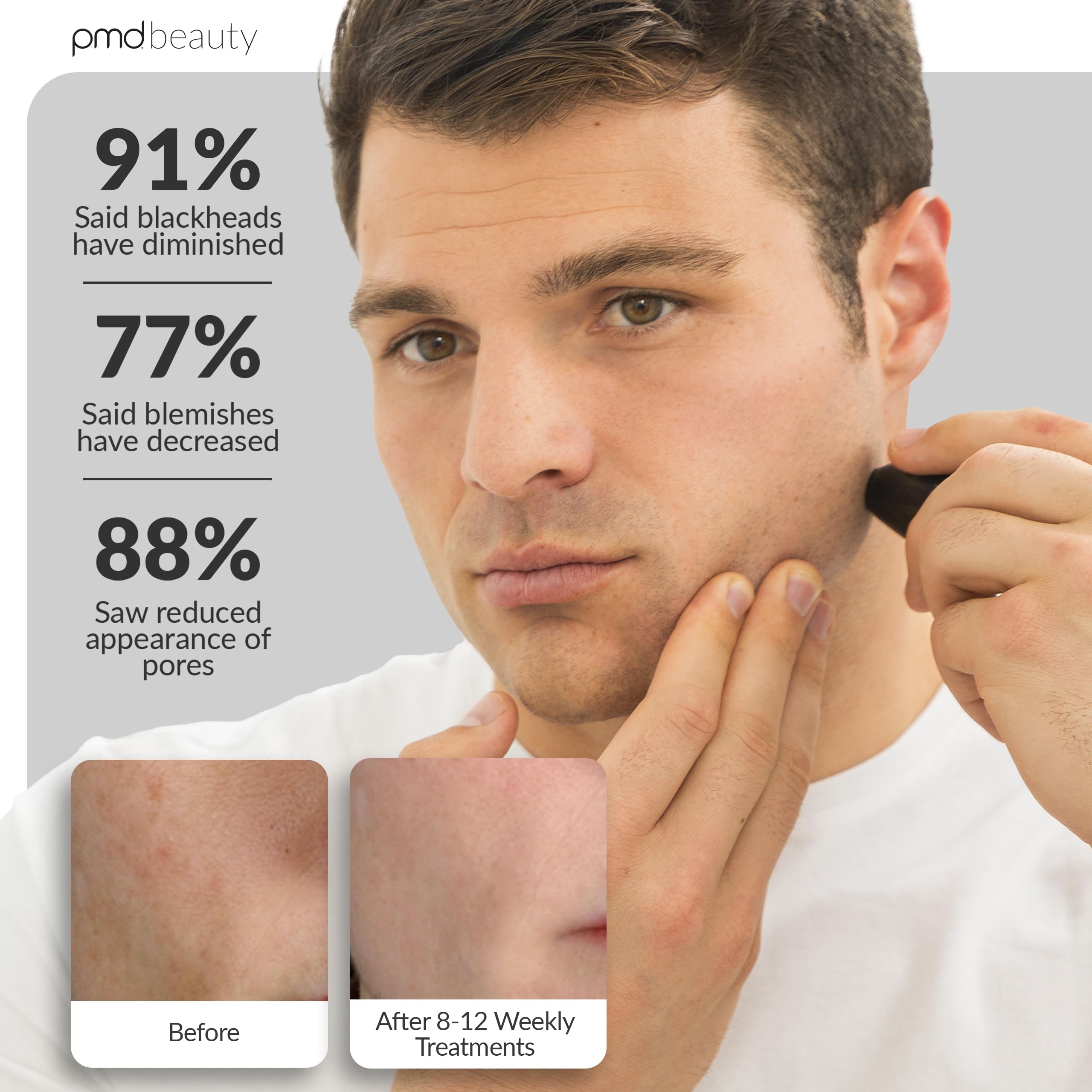 pmd-beauty-personal-microderm-man-at-home-microdermabrasion-machine image 4