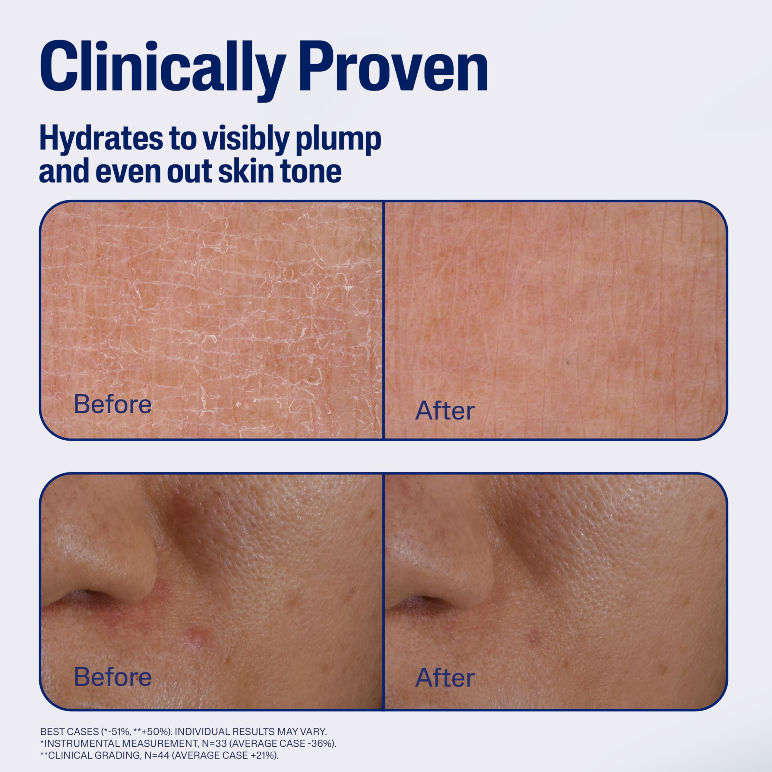 cetaphil-repair-renew-night-serum-with-gallic-acid-vitamin-e-1-fl-oz-for-stresse image 5