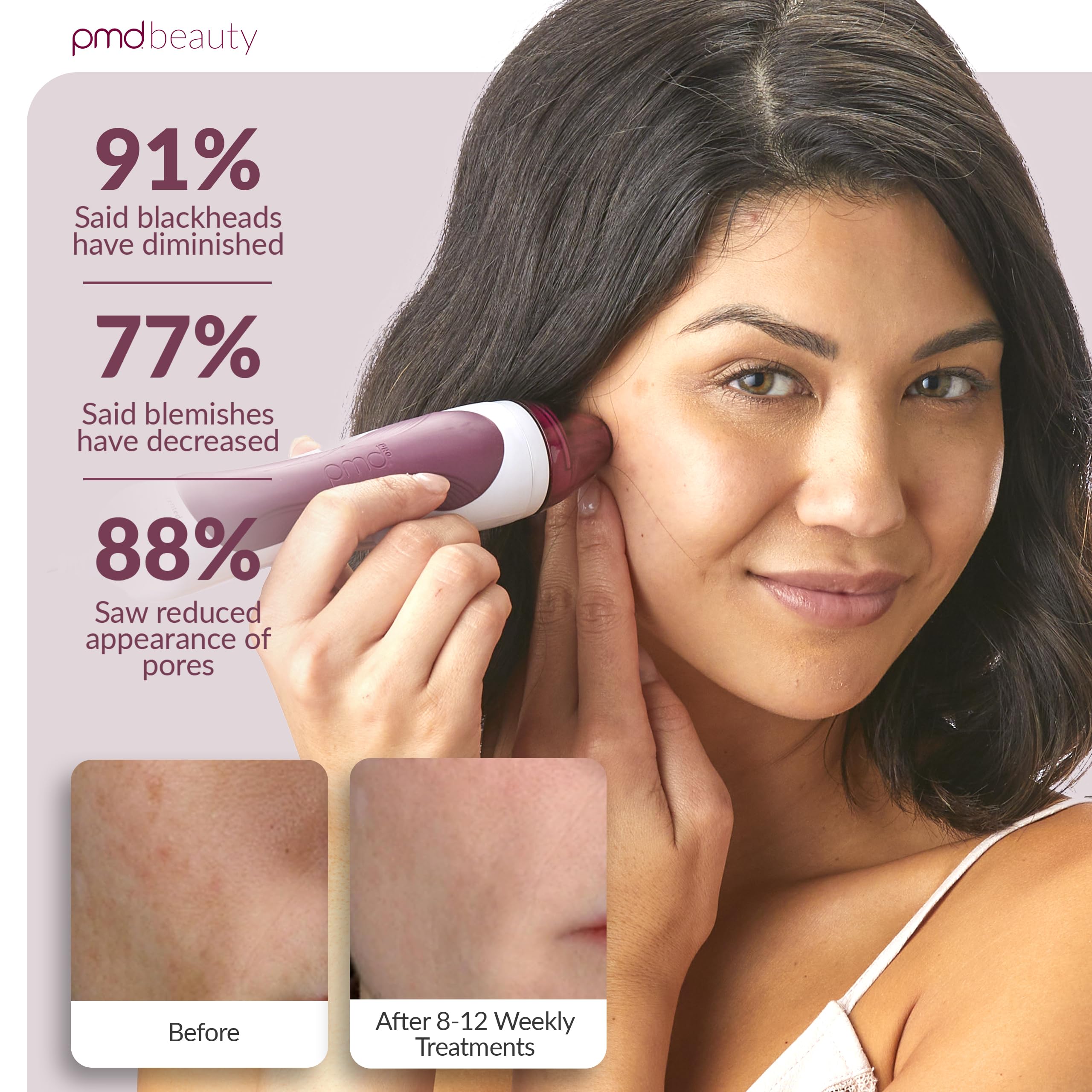 pmd-beauty-personal-microderm-pro-at-home-microdermabrasion-machine image 4